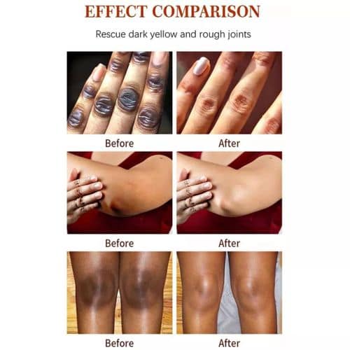 Dark Spot Corrector Cream - Image 5