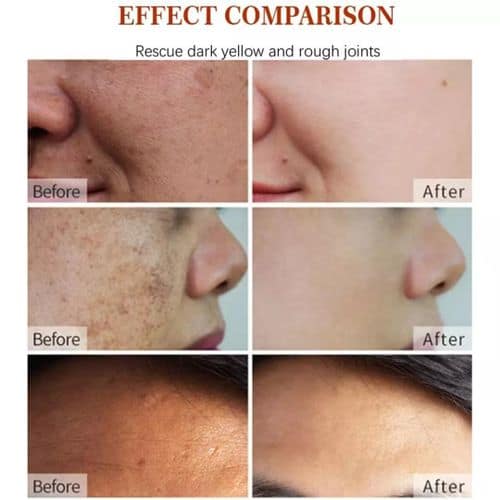 Dark Spot Corrector Cream - Image 6